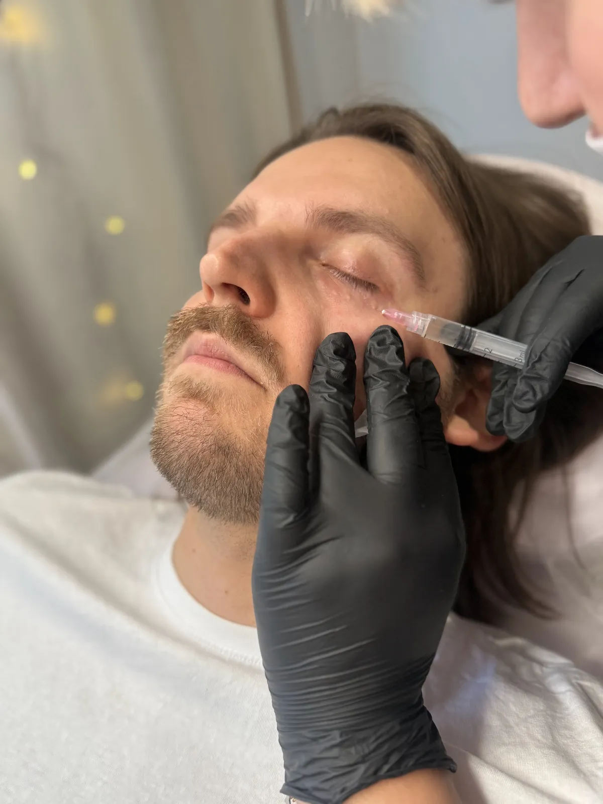 Precyzyjna mezoterapia i rewitalizacja skóry